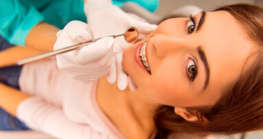 L’odontoiatria estetica fa crescere il mercato