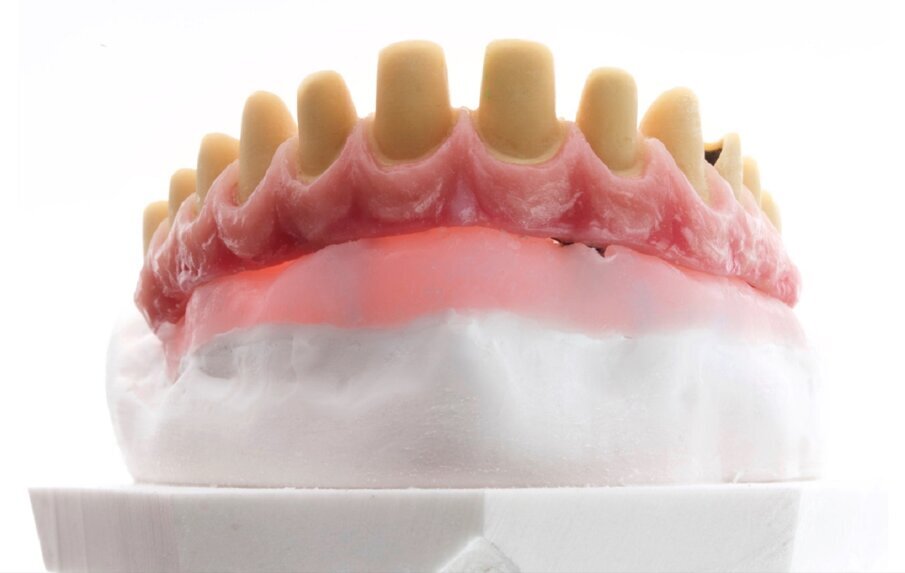 Fig. 9: Porcelain-fused-to-metal framework: pink aesthetics with GC Initial MC.