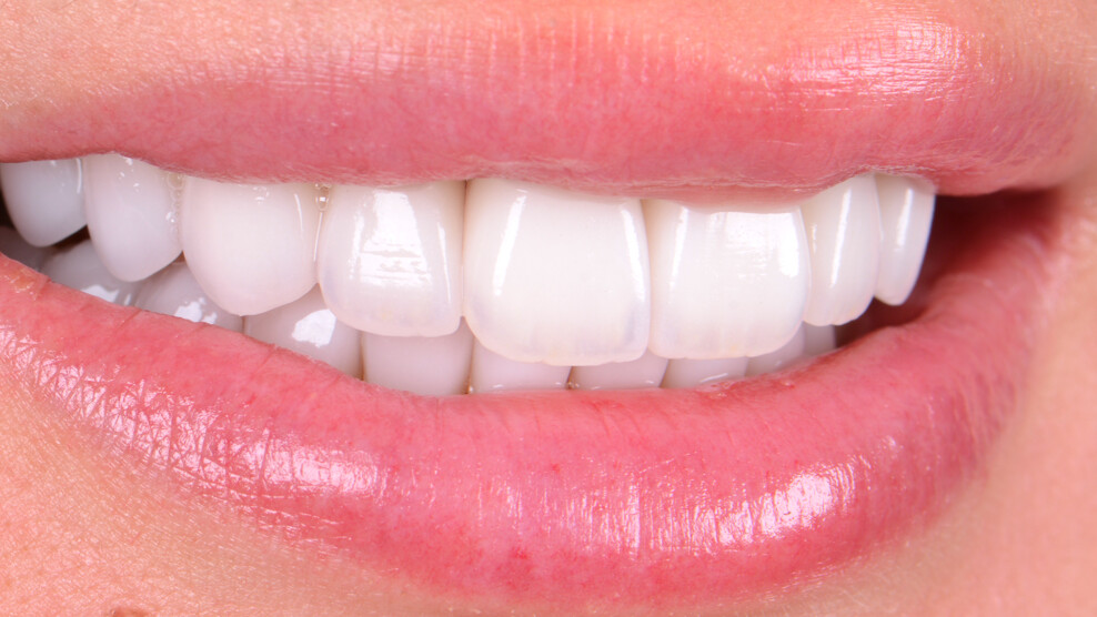 Fig. 29: Clinical situation immediately after definitive placement of the restorations.