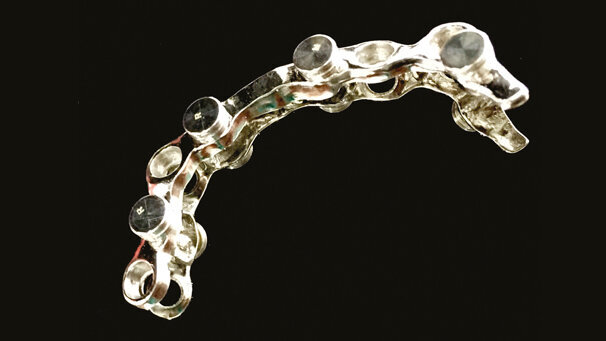 Overdenture su 4 impianti con utilizzo di attacchi OT Equator con barra passivata da elastic seeger