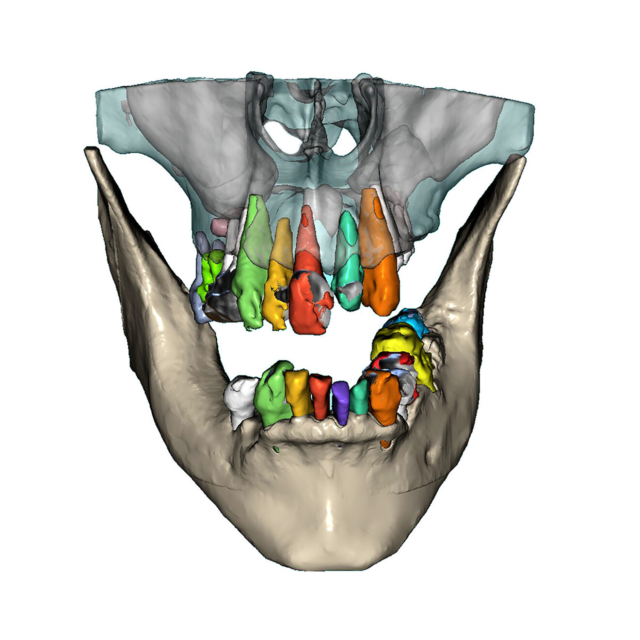 Fig. 6b: Frontal view.  