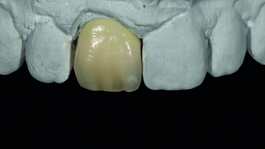 Fig. 11 : Résultat final sur le modèle.