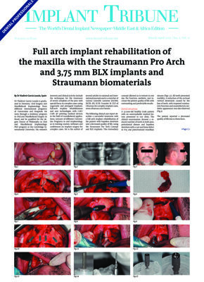Implant Tribune Middle East & Africa No.2, 2021