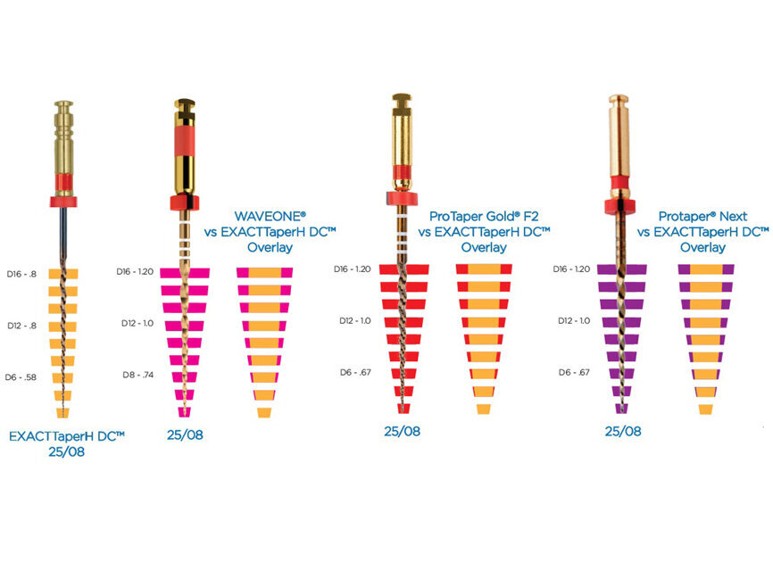 Fig. 7: Taper comparison of a size 25 file with a 08 taper between the ExactTaperH DC file and competitive files (WaveOne, ProTaper Gold and ProTaper Next) with relation to how much root structure would be removed in a coronal direction from the apex.