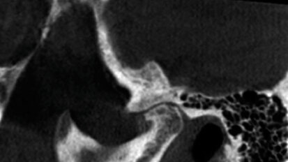 CBCT: ultimi abstracts riportati dalla letteratura