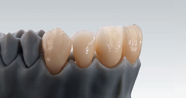 Zolid Gen-X – The new universal zirconium that changes everything