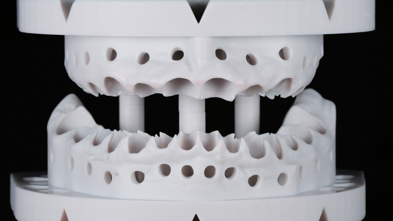 Fig. 8: Printed models with articulator mounting plates and with the dies removed.