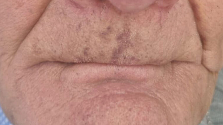 Fig. 2 - Primo incontro.