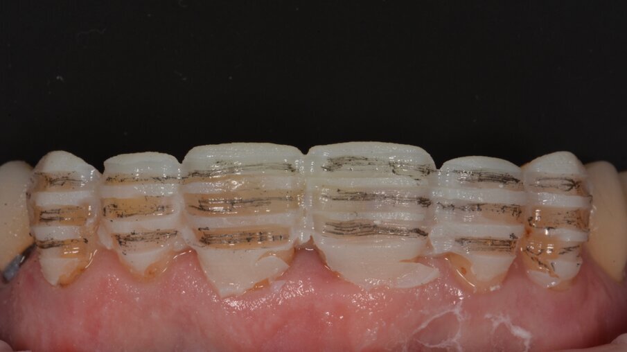 Dieptegroeven werden getrokken met een gekalibreerde boor door de mock-up om een uniforme dikte van het composiet te voorzien.