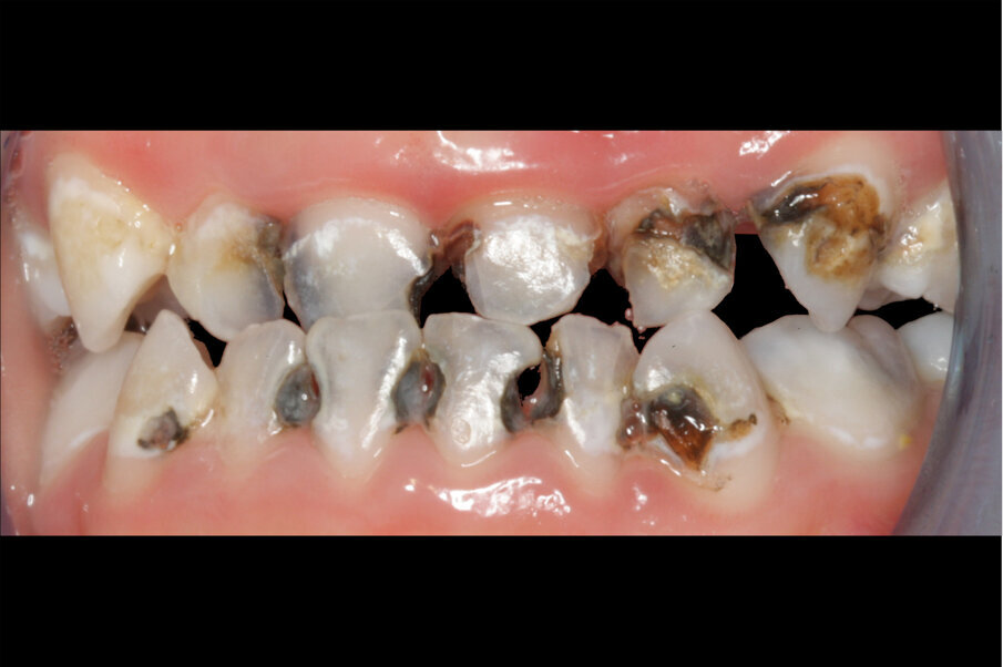 Afbeelding 4. Casus 2: 09-02-18. Tweede bezoek. Na 4 maanden klachtenvrij.