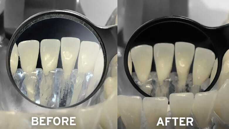 Perform at your best in diagnostic  and restorative