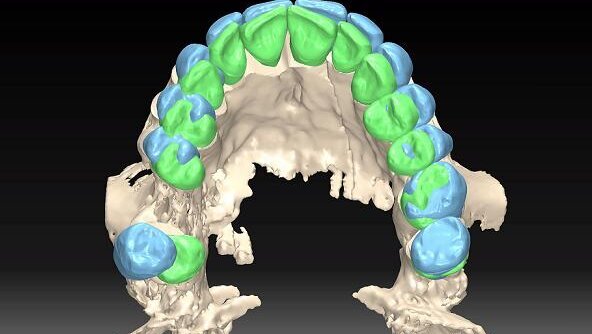CBCT in orthodontics