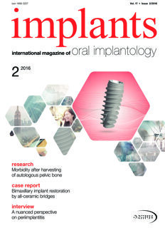 implants international No. 2, 2016 implants international No. 2, 2016