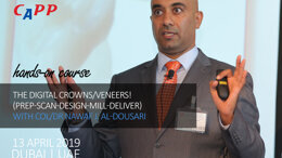 The Digital Crowns/Veneers! (Prep-Scan-Design-Mill-Deliver)