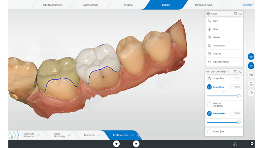CEREC Software