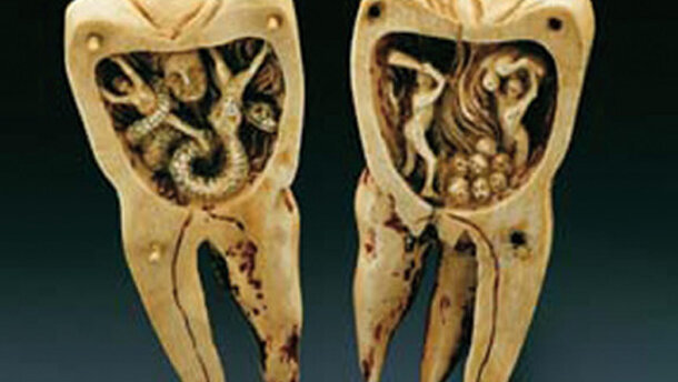 Historia de la Odontología. Capítulo II: La Odontología en las civilizaciones antíguas: Mesopotamia y Egipto