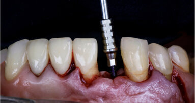 Straumann presents education highlights in May