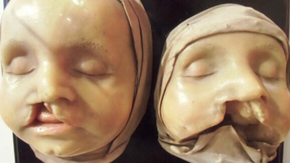 Schau über Alltag der Zahnärzte von anno dazumal