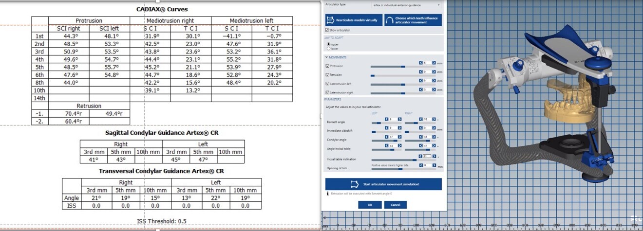 Figs. 4a & b: The virtual articulator is filled with CADIAX data.