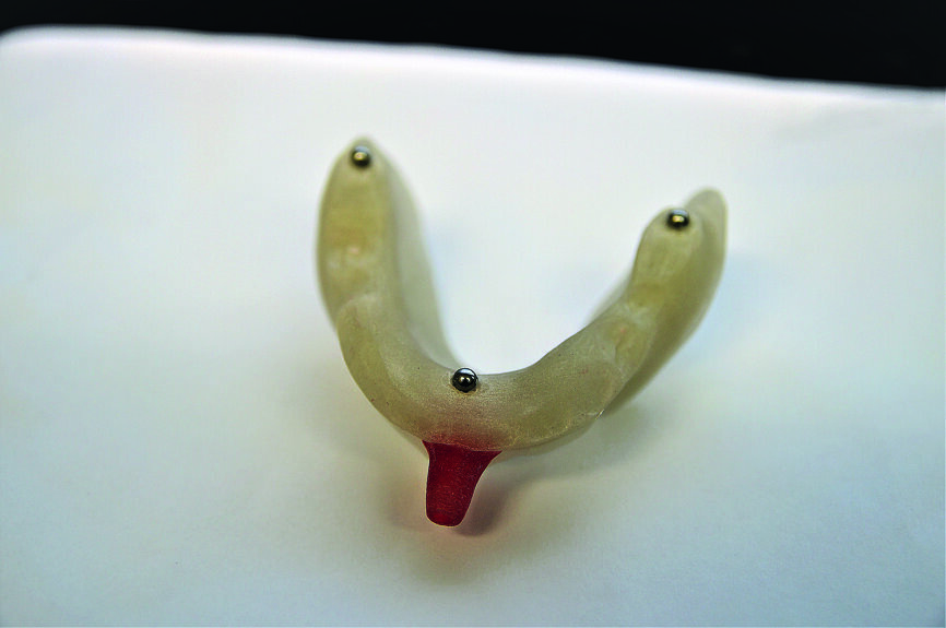 Fig. 1 : Guide radiologique avec trois billes de référence. 