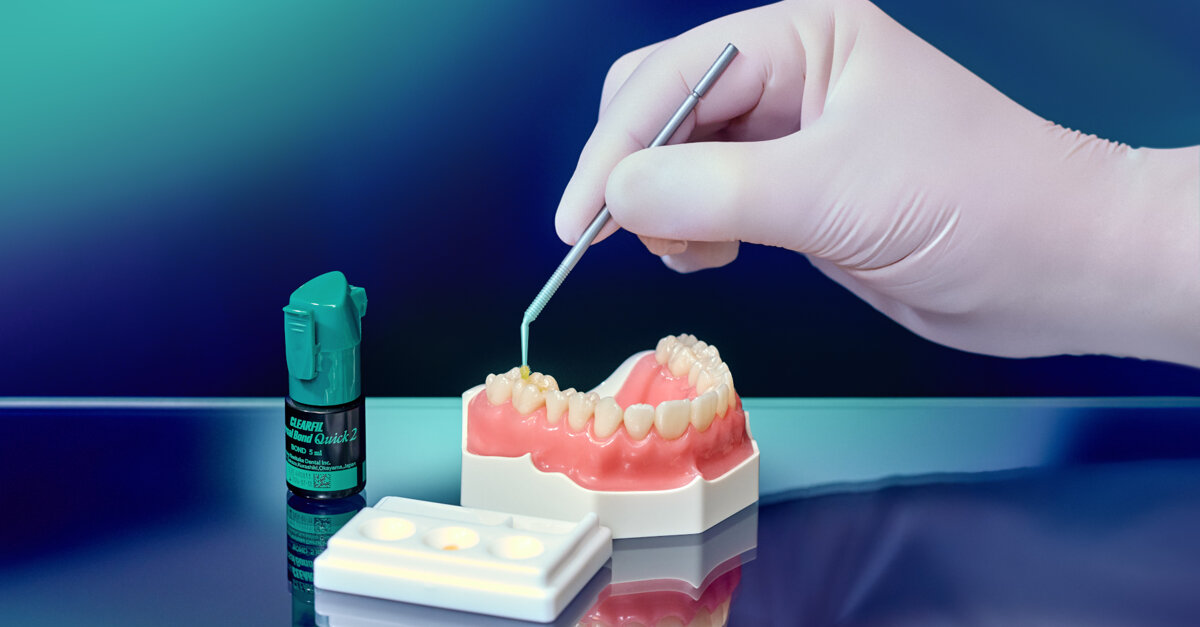 Bonding agent receives two DENTAL ADVISOR awards