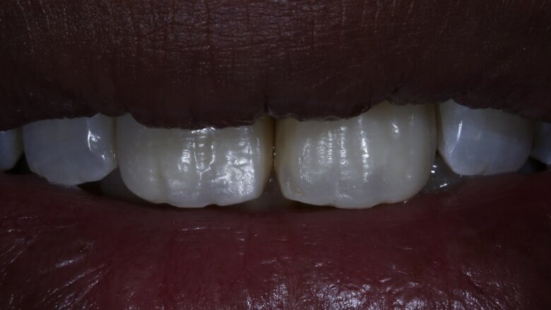 Fig 19 Surface texture