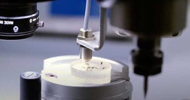 Gli scienziati identificano nei denti i biomarcatori per le malattie neurologiche