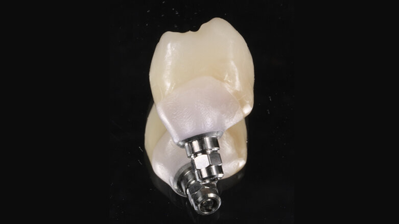 The material of the future for all kinds of indications