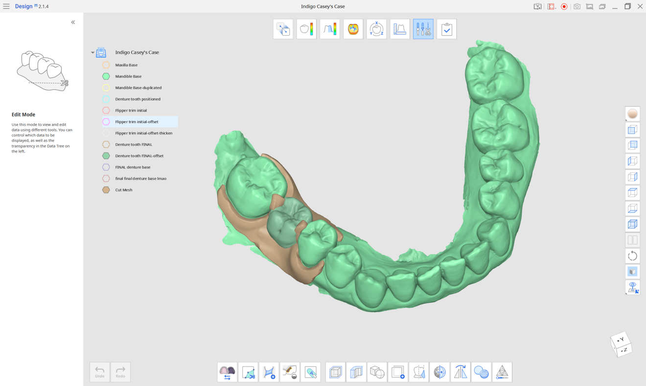 Fig. 1a: Denture base and tooth designed as separate components in Medit Design.