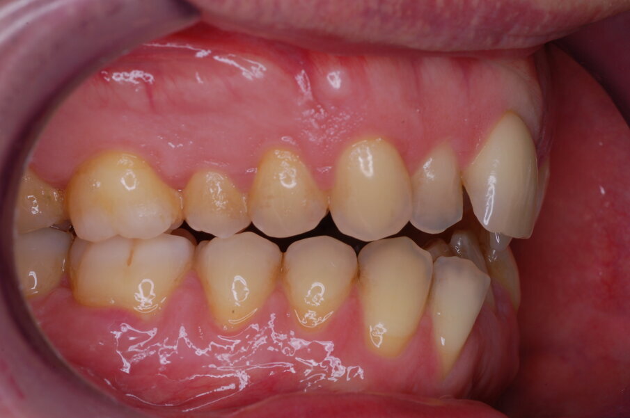 Figg. 1-8_Fotografie facciali e intraorali pre-trattamento.