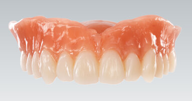 Ceramill FDS bietet nun auch Möglichkeit Zahnkränze und Zahnsegmente zu fräsen