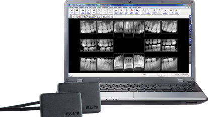 Digital X-ray sensor achieves lowest radiation exposure levels