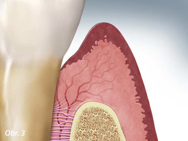 Obr. 3: Návrat ke zdravému stavu