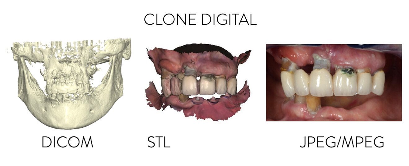 Figs. 4a–c : Combinaison des différents fichiers indispensables pour collecter toutes les données nécessaires au diagnostic, au plan de traitement et à la bonne exécution de celui-ci. (a) CBCT (DICOM). (b) Photographie intra-orale. (c) JPEG/MPEG.