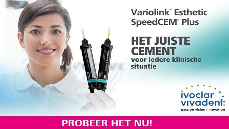 Bevestigingscement en bevestigingscomposiet: hoe maakt u de juiste keuze?