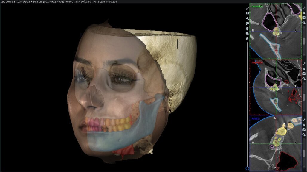 Applicazioni dell’intelligenza artificiale in Ortodonzia