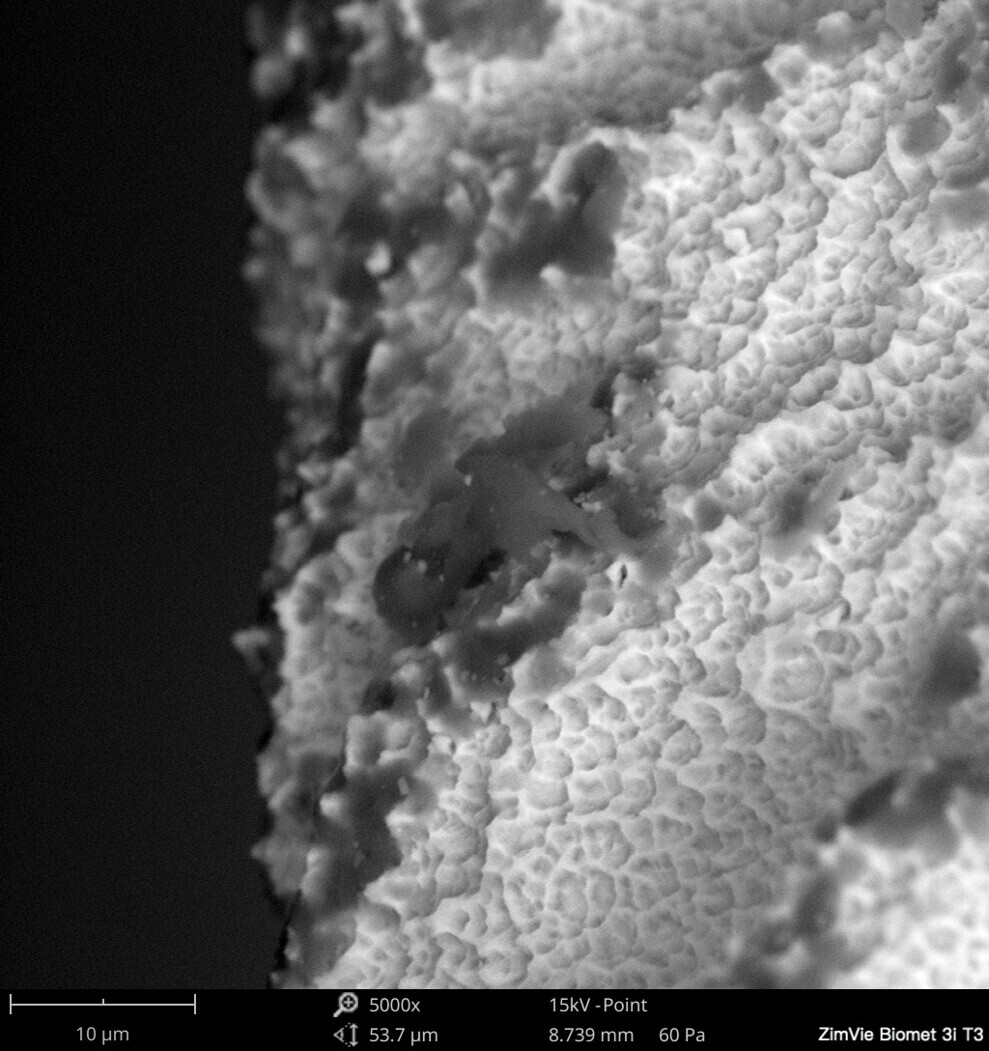 Fig. 5: Carbonaceous particles (polysiloxanes) on a titanium implant at the implant apex of a titanium implant (T3, ZimVie). SEM 500× magnification.