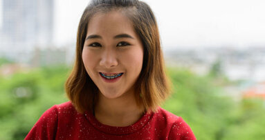 Asia Pacific: Significant shift in attitudes towards braces
