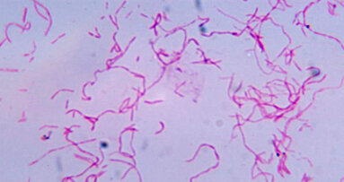 Un patogeno orale protegge le cellule tumorali contro le cellule immunitarie
