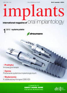 implants Poland No. 1, 2013