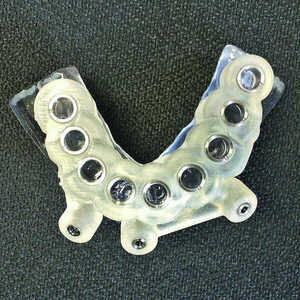 Fig-8-Guide-chirurgical-pour-implants-mandibulaires-300x300-