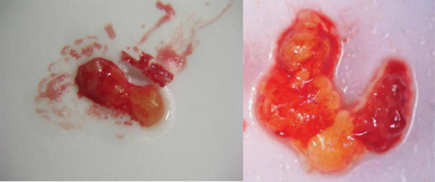 Fig. 6 : Autres exemples du contenu de zones FDOJ curetées (© Dr Johann Lechner).