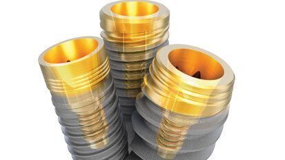 Trusted implant designs, united in one connection