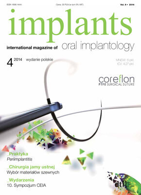 implants Poland No. 4, 2014 implants Poland No. 4, 2014