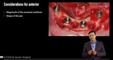 Nobel Biocare представя безплатен онлайн курс за системата All-on-4