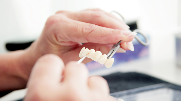 Einigung bei den Preisverhandlungen für Zahntechnik