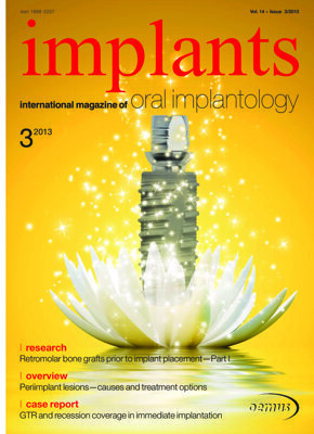 implants international No. 3, 2013 implants international No. 3, 2013