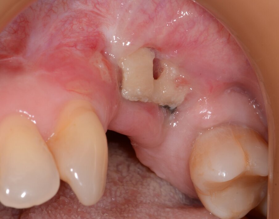 Fig. 8: Initial situation.