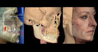 Reivindicación de la Cefalometría