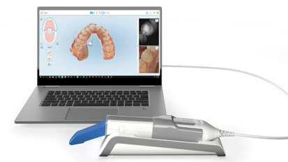 Seeing is believing: iTero Element 5D Imaging System